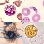 Profile Picture of William Morales (@Wilmohur) (@laboratorio_microscopico) on Instagram