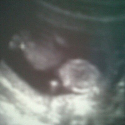 Profile Picture of Conor Mccullough (@feet_buffon) on Twitter