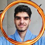 Profile Picture of رویش مجدد مو/ریش و سبیل (@zibakadeh.amir) on Instagram