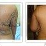 Profile Picture of Lipoescultura Tecnica Europea (@johnarmandolios) on Instagram