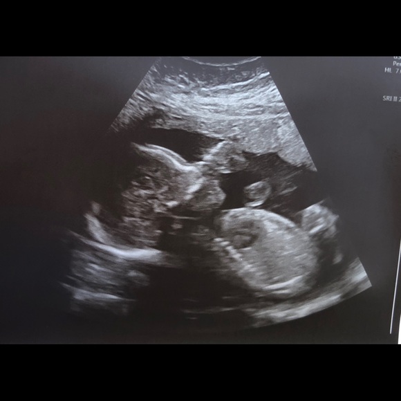 Profile Picture of Fernando Peraza (@nandooo1993) on Poshmark