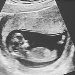 Profile Picture of Little Leo, Baby 2 & Family (@leo__liebe) on Instagram