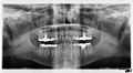 Profile Picture of Panoramic radiographon Wikipedia