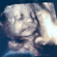 Kayci Arcudi - Quora Profile Picture of Kayci Arcudi (@kayci-arcudi) on Quora