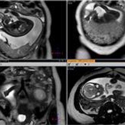 Cheryl Edwards - Twitter Profile Picture of Cheryl Edwards (@leland2011) on Twitter