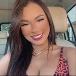 Profile Picture of Dra. Jéssica Sousa - Harmonização Facial (@jessousap) on Instagram