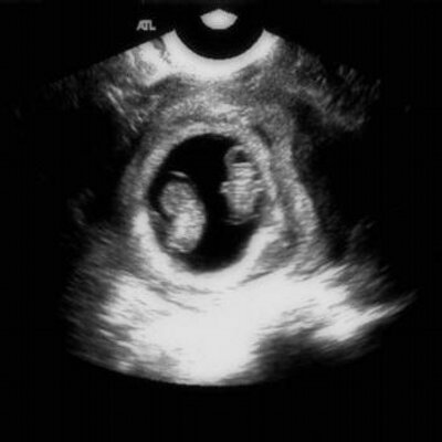 Profile Picture of Chris Batson (@chrisbatson09) on Twitter