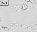 Profile Picture of Balamuthia mandrillarison Wikipedia