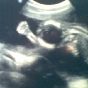 Profile Picture of David Finlaw (@lovennudes) on Myspace