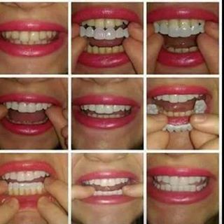 Profile Picture of Dentiste Youssef (@Dentiste-Youssef) on Facebook