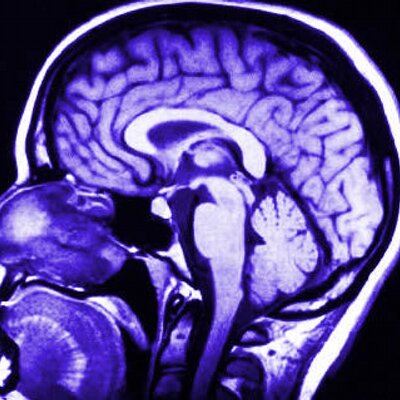 Profile Picture of Bryan Andre Soloman (@NeuroNews) on Twitter