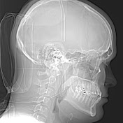 Patrick Peach - Youtube Profile Picture of Patrick Peach (@PatrickPeach) on Youtube