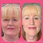 Profile Picture of Cindy Adler (@cindymsemle) on Instagram