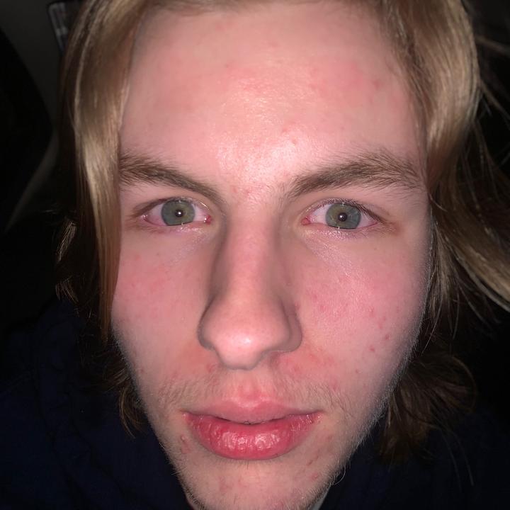 Profile Picture of Tyler (@tyleraucoin07) on Tiktok