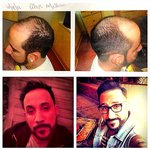 Profile Picture of Lanny Gayne (@meyersscottiemey4767) on Instagram