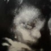 Profile Picture of Amy Hummel (@ajhummel09) on Pinterest