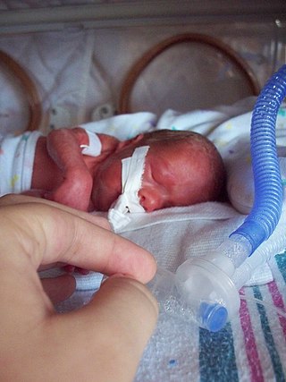 Profile Picture of Preterm birthon Wikipedia