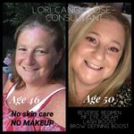 Profile Picture of Lori Reitzen Cangiolose (@loricangiolose3) on Instagram