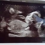 Profile Picture of Corey Mace (@shady_midget) on Instagram