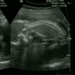 Profile Picture of آماندا صفاریان (@amanda_saffarian) on Instagram