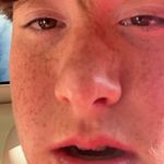 Profile Picture of Aidan lennon (@aidan.glenoak.fanpage) on Instagram