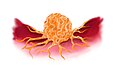 Profile Picture of Reduction-sensitive nanoparticleson Wikipedia