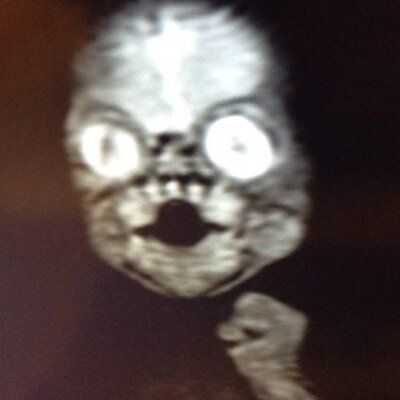 Profile Picture of Neeraj Singh (@NSinghShady) on Twitter