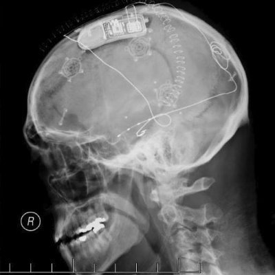 Daniel Stempien - Twitter Profile Picture of Daniel Stempien (@sknmstr) on Twitter