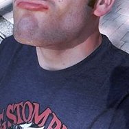 Profile Picture of Chin Reduction Surgery GoFundMe (@AdamMurphy) on Twitter