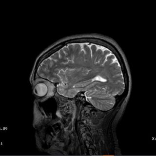 Profile Picture of Clare Tyler Lewandowski (@clare75bear) on Instagram