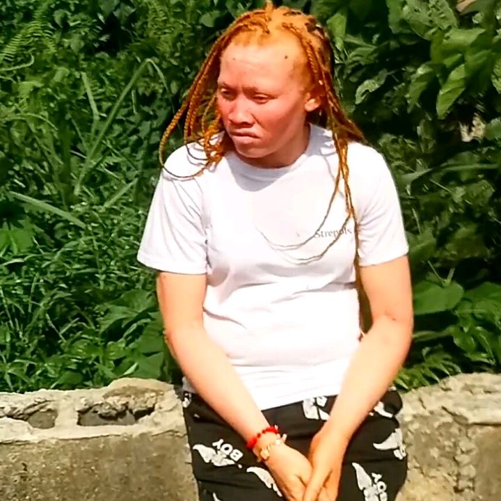 Albino_Special - Tiktok Profile Picture of Albino_Special (@reginarachael1) on Tiktok