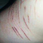 Profile Picture of jeanine (@selfharm_cutting_girl_) on Instagram