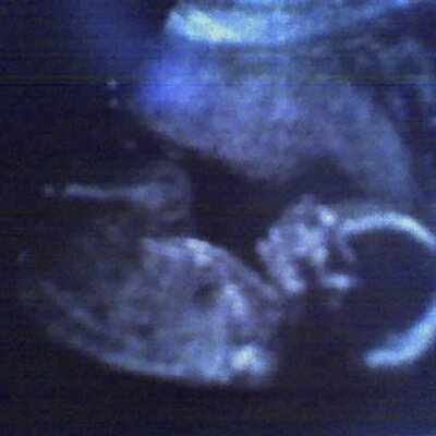 Profile Picture of Sherri Paulson (@SherriPaulson) on Twitter