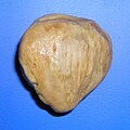 Profile Picture of Attenuated patella alta - Wikipediaon Wikipedia