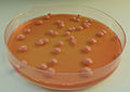 Profile Picture of Brettanomyces - Wikipediaon Wikipedia