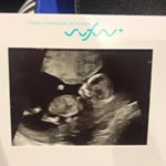 Profile Picture of Archer Ray Bowers (@baby_archer_ray) on Instagram