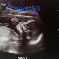 Profile Picture of Alexandra Hayden (@alexandra-hayden-3) on Quora