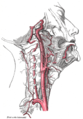 Profile Picture of Carotid artery dissection - Wikipediaon Wikipedia