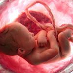 Profile Picture of Victoria and Julia (@embryonicandfetaldevelopment) on Instagram