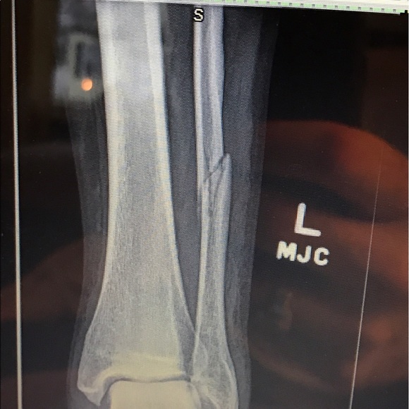 Profile Picture of Christopher Reall (@cbreall) on Poshmark