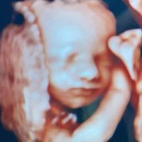 Profile Picture of James Jacko (@james-jacko-2) on Quora