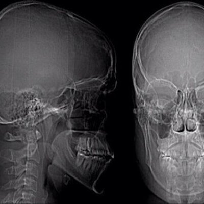 Profile Picture of Kyle Tycz (@NinjaEnder) on Twitter