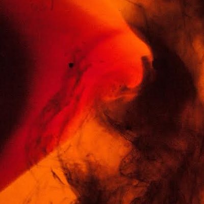 Profile Picture of Chris Vest (@StringaVest) on Twitter