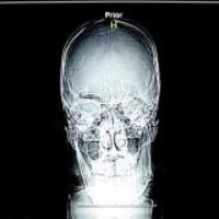 Profile Picture of Christopher Hsieh (@christopher-hsieh-1) on Quora