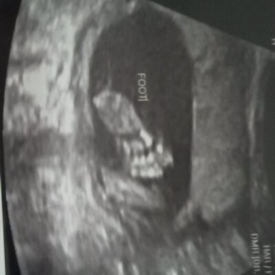 Profile Picture of Teri Cunningham (@terim5051teri) on Twitter
