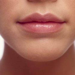 Profile Picture of Samantha Watters (@coldsores) on Pinterest