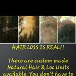 Profile Picture of Chenel Thomas (@loccranialprosthesis) on Instagram