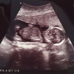 Profile Picture of Jacob Tong (@tong_jacob) on Instagram