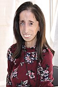 Profile Picture of Lizzie Velásquez - Wikipediaon Wikipedia