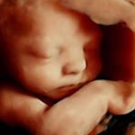 Profile Picture of Dr. Manuel Castillo Soltero (@manuelcastillosol) on Instagram